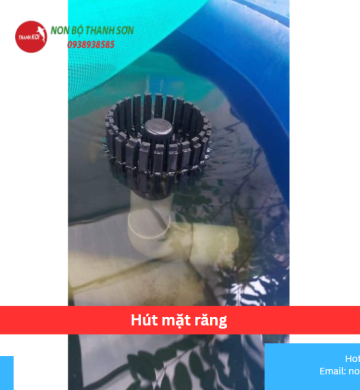 Hút mặt răng